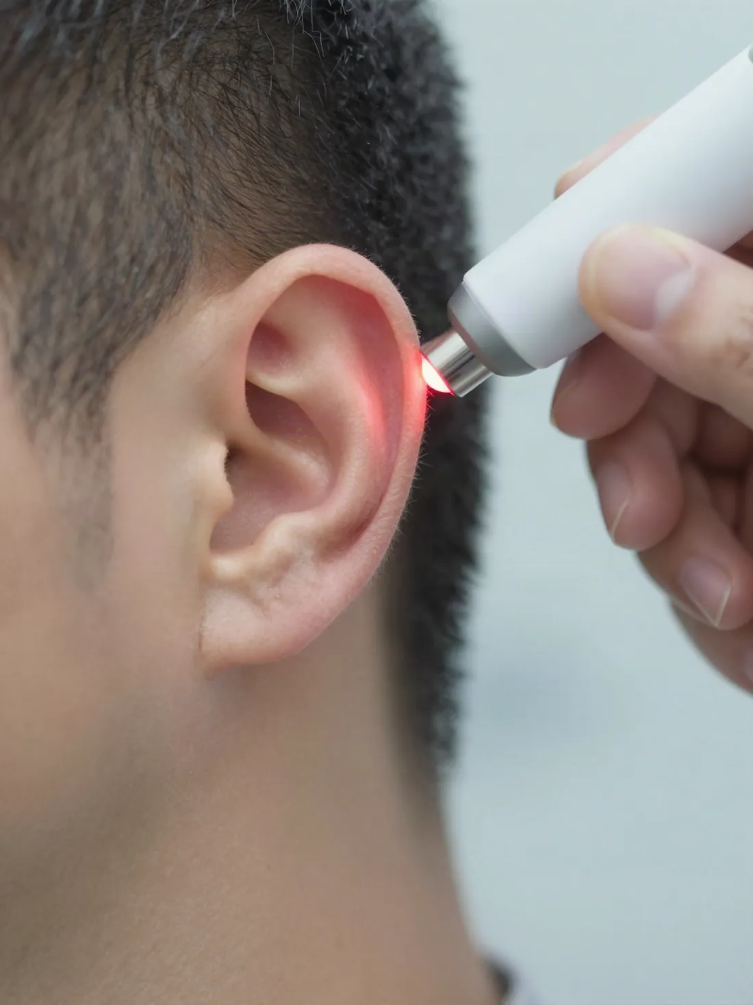 Aplicación del láser medicinal en un punto de auriculoterapia de la oreja